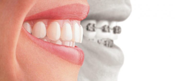 Causas del dolor con la ortodoncia