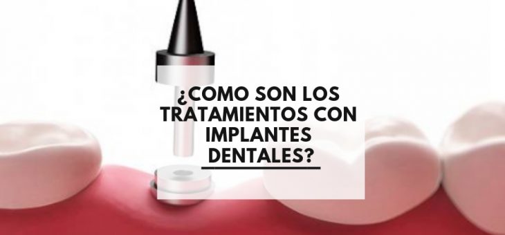 ¿Como son los tratamientos con implantes dentales?
