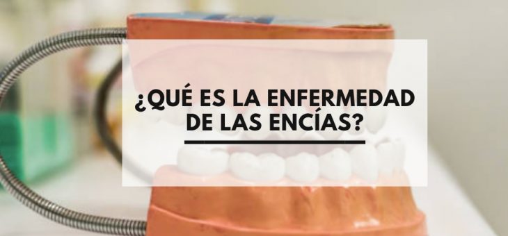 ¿Qué es la enfermedad de las encías?