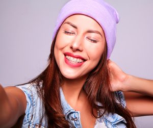ortodoncia tradicional y ortodoncia invisalign en Tegueste Tenerife Gadir Dental