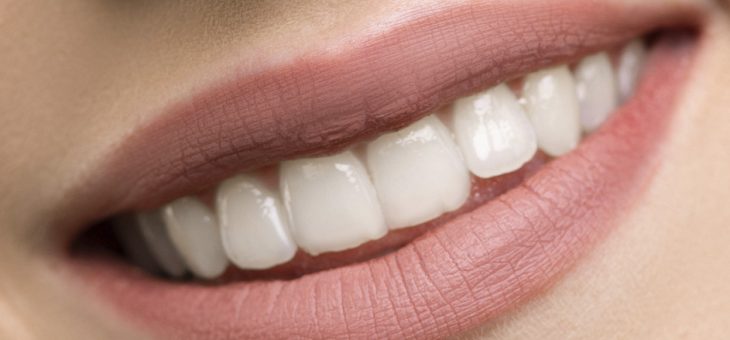 ¿Cómo mantener blancos los dientes?