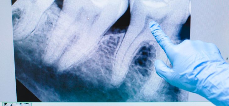 TAC dental: tu boca en 3D