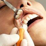 higiene dental gadir dental