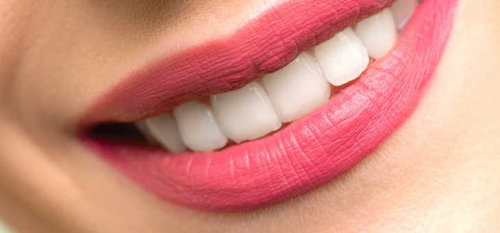 Tipos de blanqueamiento dental en Tenerife