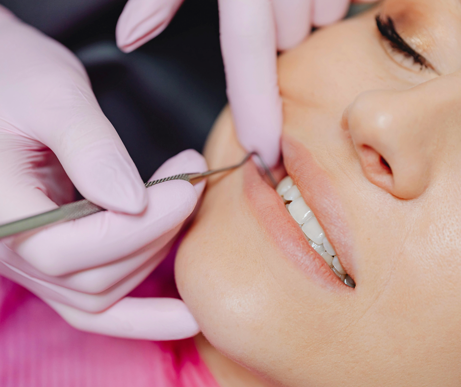Dente Raspado Limpieza dental y raspado: ¿son lo mismo? - Blog Gadir Dental