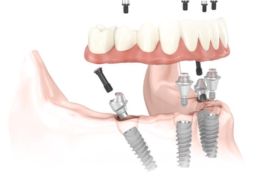 Ofrecemos las más avanzadas especialidades en Odontología
